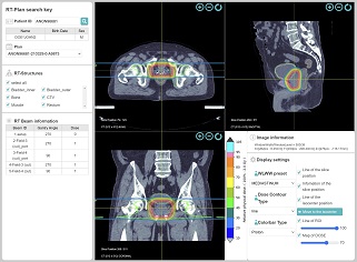 DICOM-RTViwer