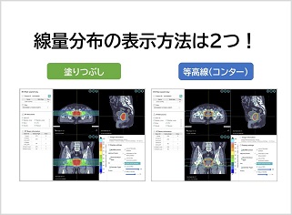 DICOM-RTViwer